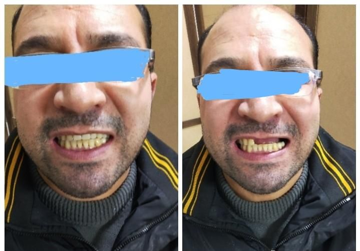 دندانسازی ساخت انواع دندان مصنوعی|خدمات آرایشگری و زیبایی|مشهد, رسالت|دیوار