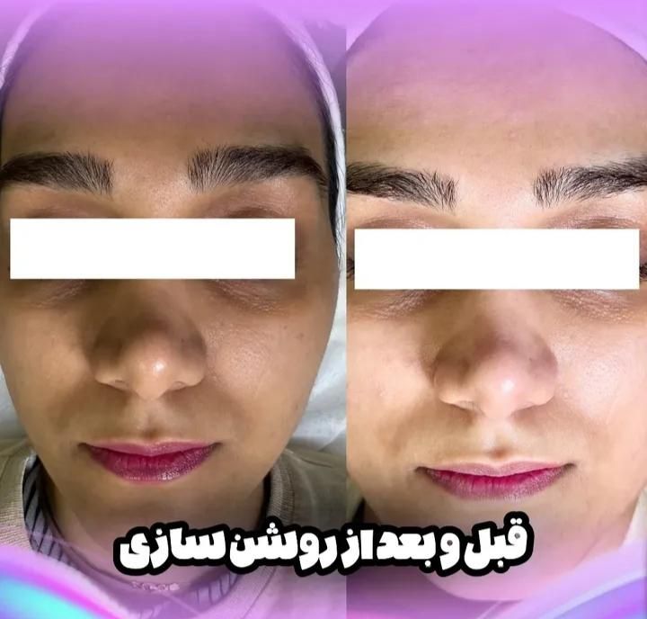 پاکسازی تخصصی پوست صورت|خدمات آرایشگری و زیبایی|اصفهان, فرح آباد|دیوار