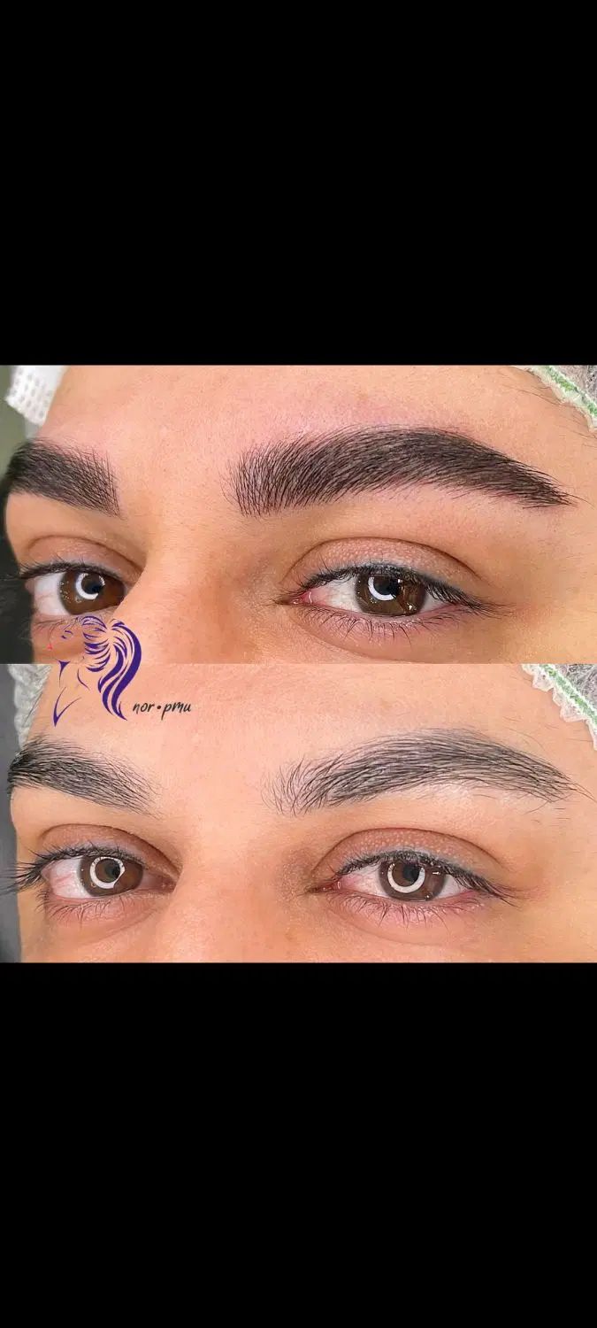 میکروبلیدینگ و فیبروز روی تتو های قدیمی|خدمات آموزشی|کرمانشاه, |دیوار