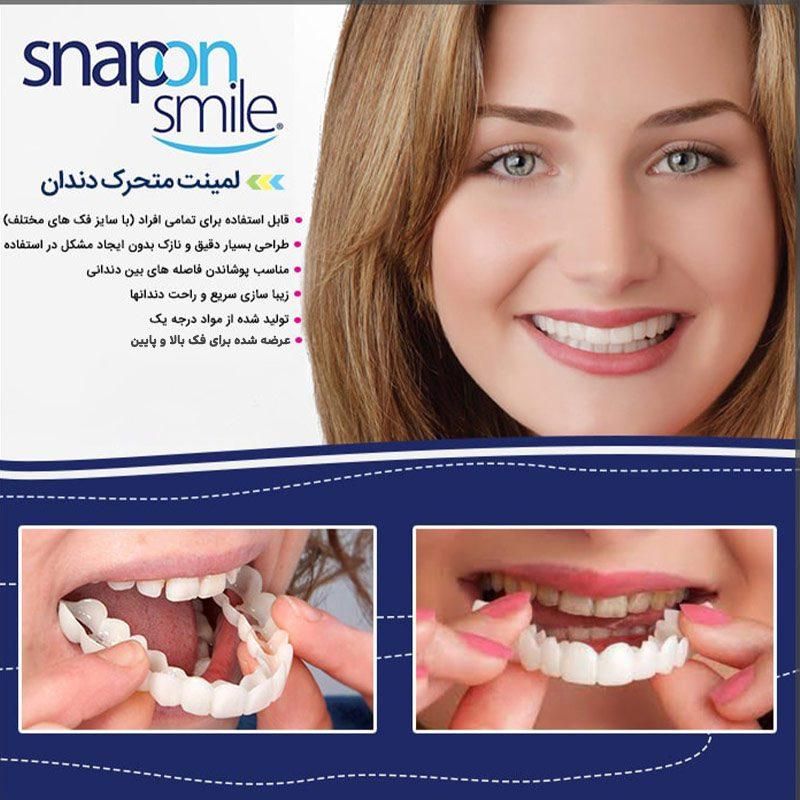 لمینت‌متحرک/دوفک/پرداخت درمنزل/روکش/ترواسمایل|آرایشی، بهداشتی، درمانی|مشهد, طلاب|دیوار