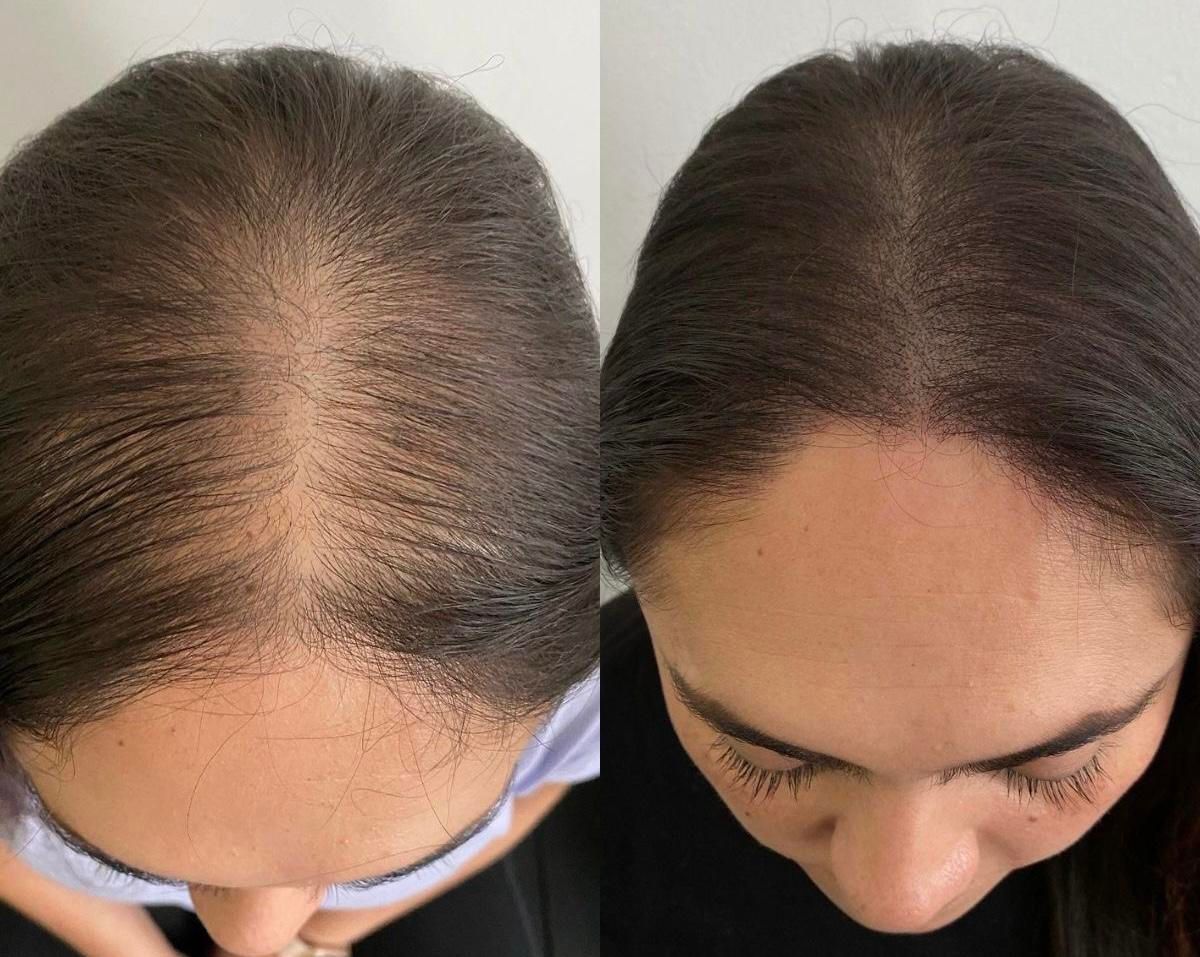 ۵۰٪تخفیف خدمات پیگمنتیشن و میکروبلیدینگ ویژه مرداد|خدمات آرایشگری و زیبایی|تهران, درختی|دیوار