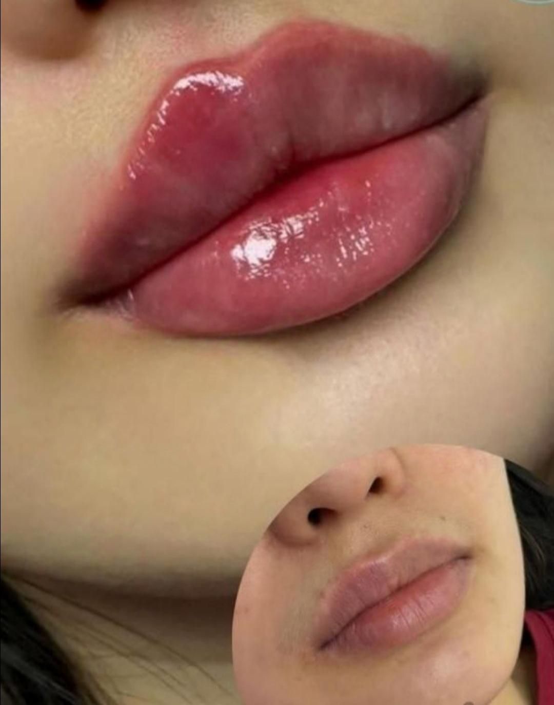 جشنواره تزریق ژل و بوتاکس وانزیم|خدمات آرایشگری و زیبایی|ملارد, |دیوار