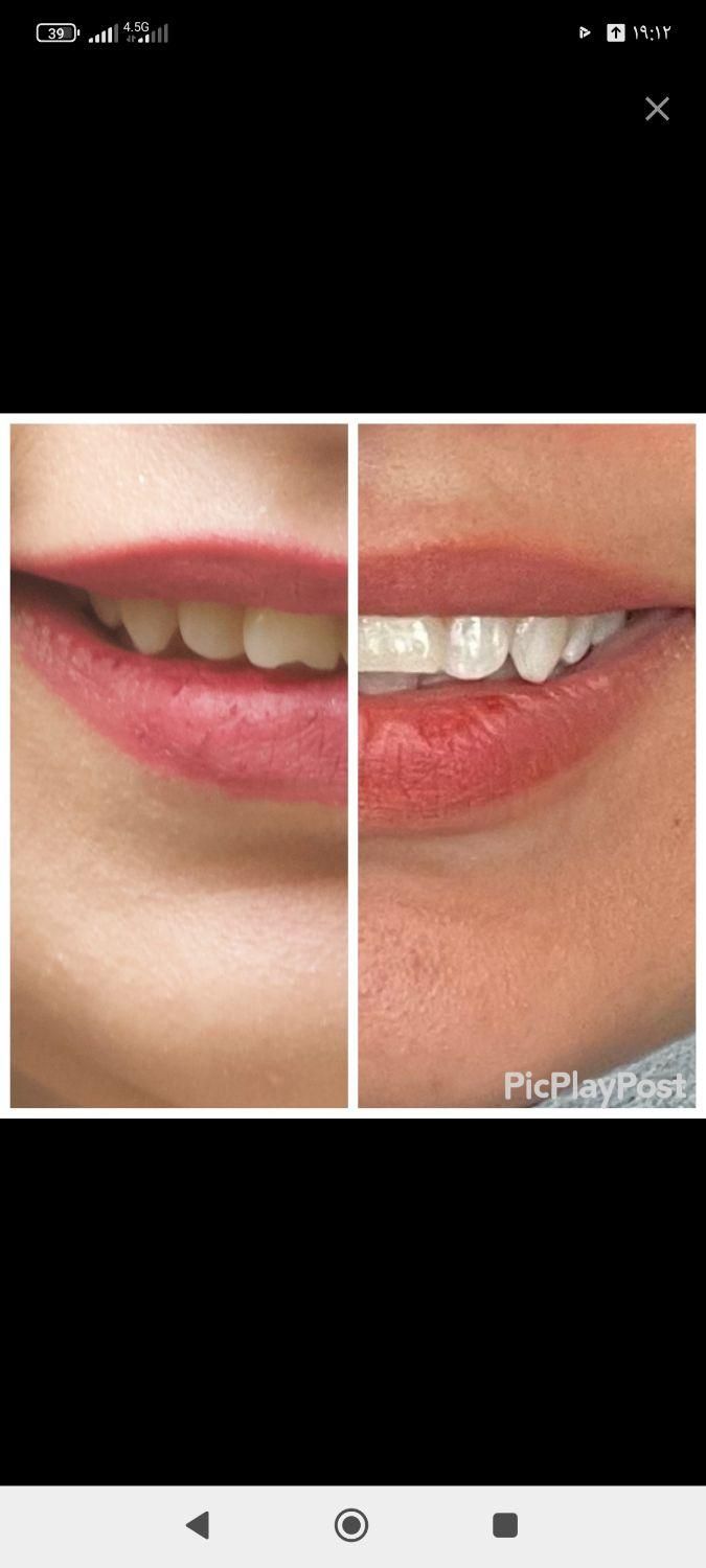 ارتودنسی لبخندی زیبا(فقط تا آخر ماه)|خدمات آرایشگری و زیبایی|مشهد, آزادشهر|دیوار