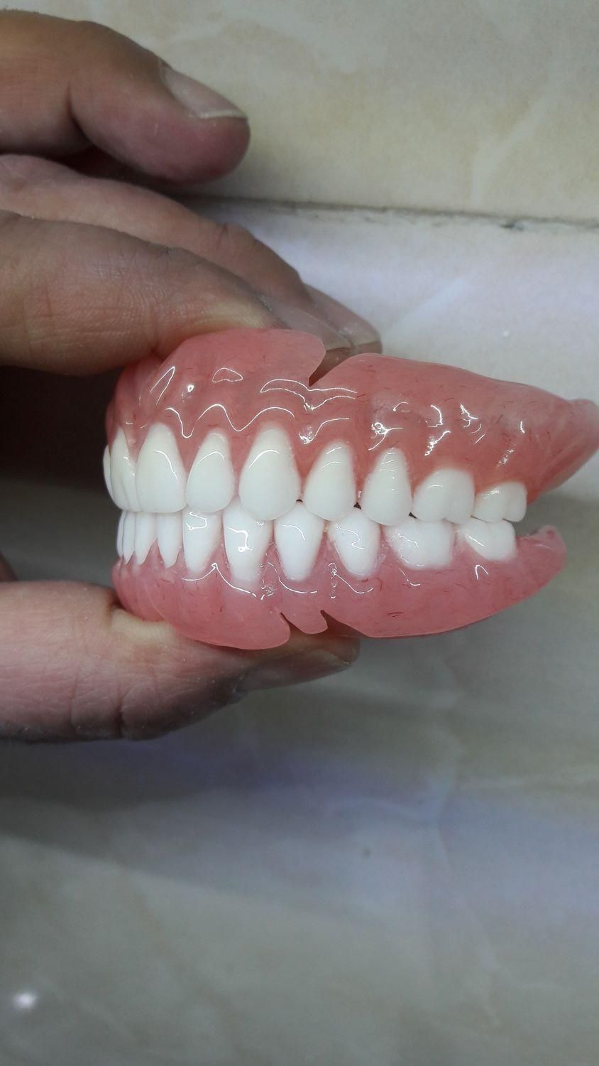 دندان مصنوعی|خدمات آرایشگری و زیبایی|قرچک, محمد آباد|دیوار