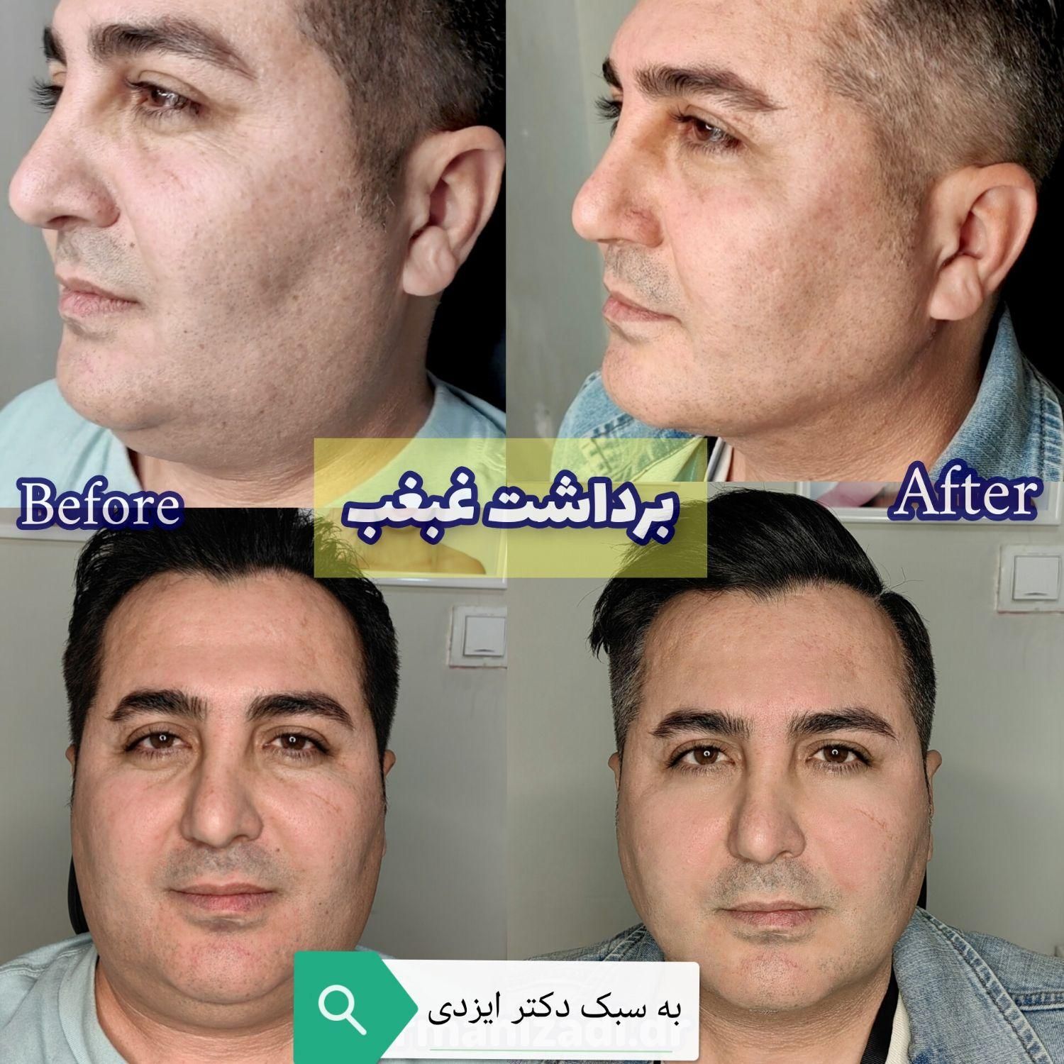 جراحی زیبایی ابرو شقیقه لابیا تنگی بیکینی واریس|خدمات آرایشگری و زیبایی|صدرا-فارس, فاز ۱|دیوار