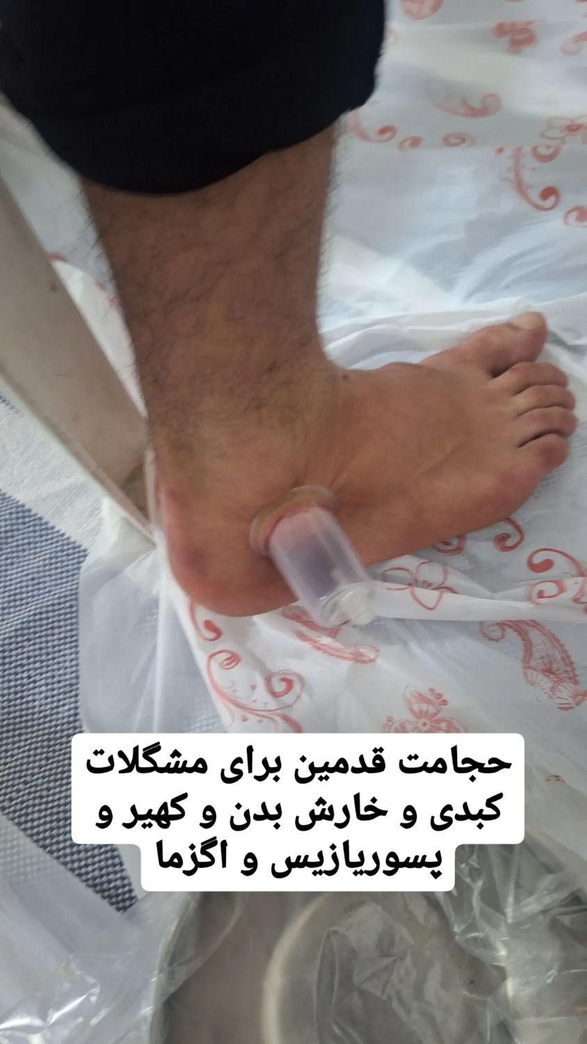 حجامت و زالو درمانی و بادکش ب صورت تخصصی|خدمات آرایشگری و زیبایی|شیراز, شهرک ولیعصر|دیوار