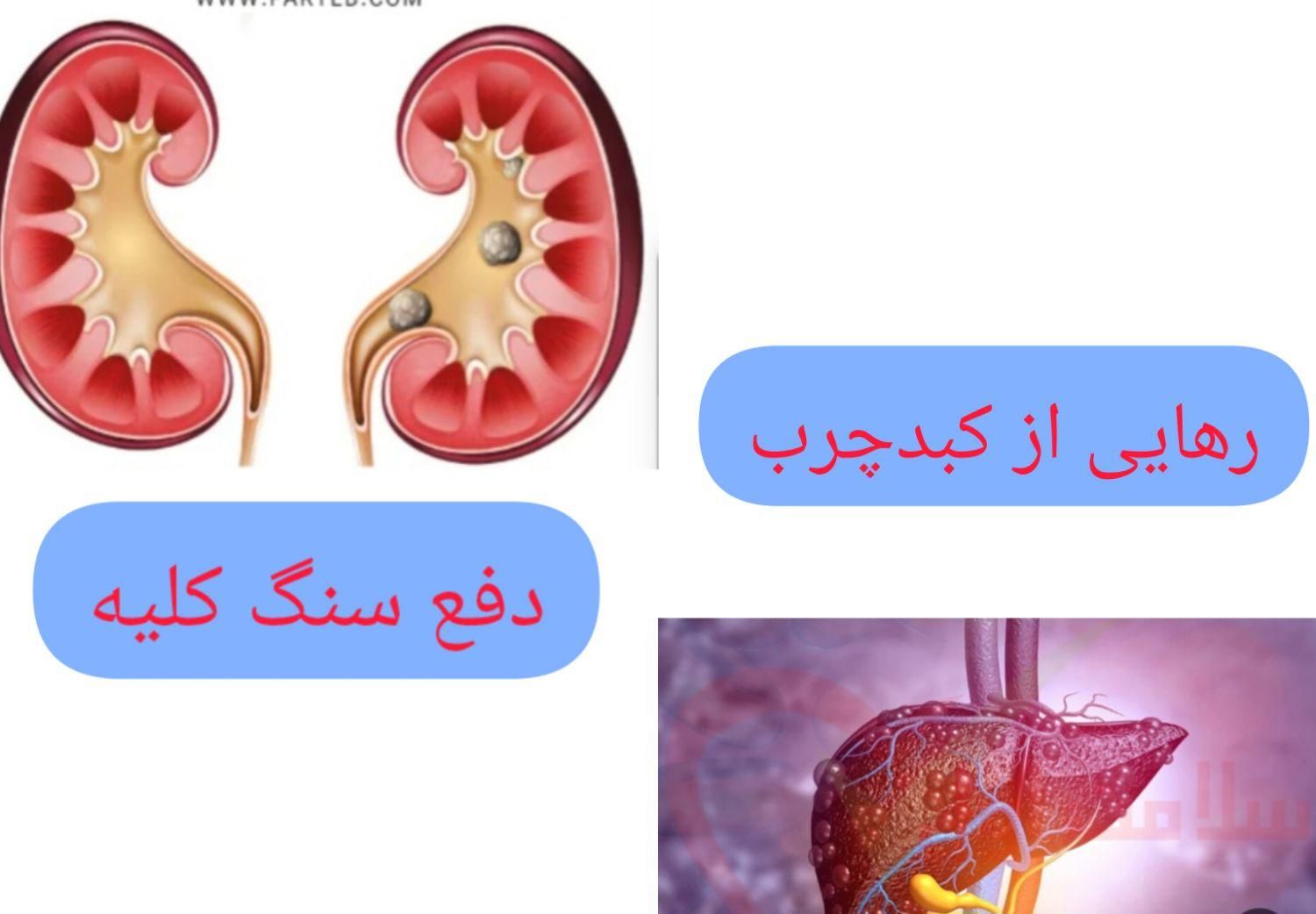 سنگ کلیه وکبدچرب(گیاهی)|خدمات آرایشگری و زیبایی|تهران, میدان انقلاب|دیوار