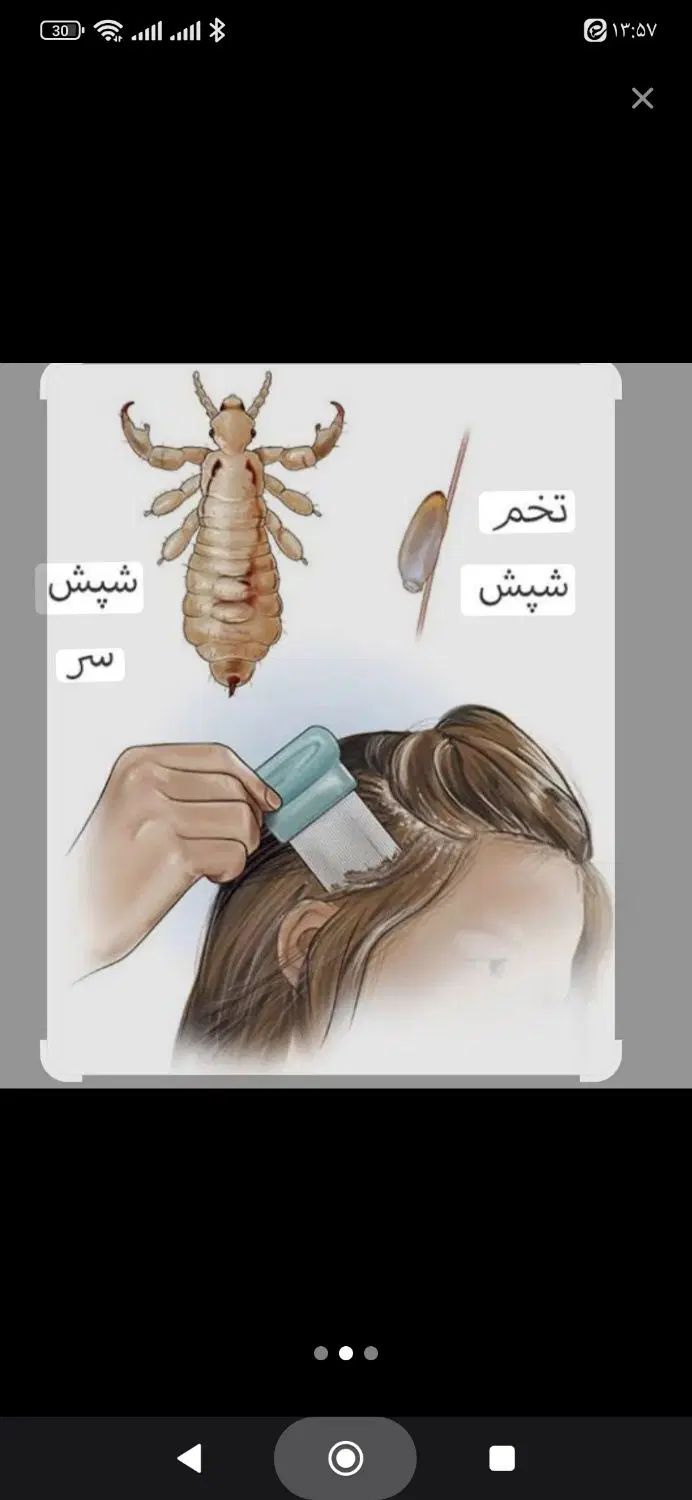 محلول گیاهی شپش و رشک فوق‌العاده و بدون ضرر|آرایشی، بهداشتی، درمانی|سبزوار, زینبیه|دیوار