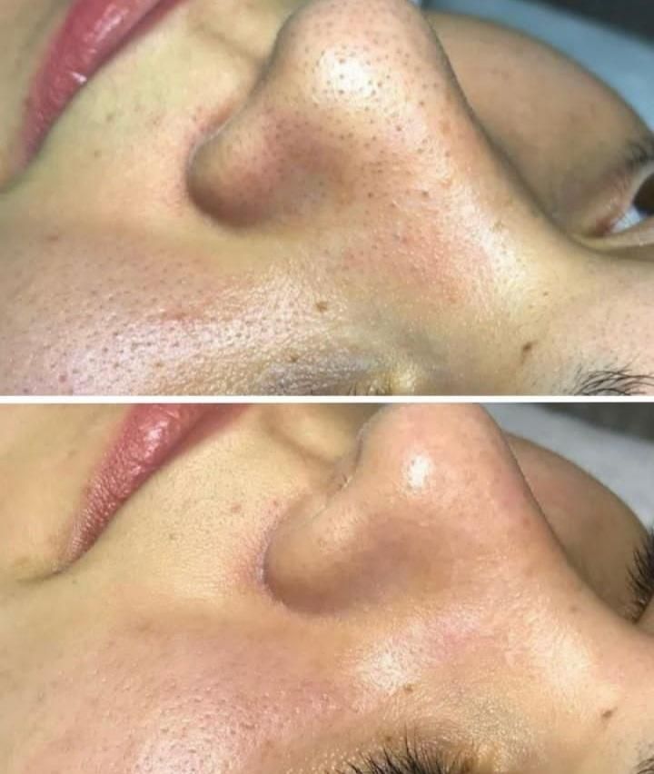 انجام کلیه خدمات پاکسازی پوست بصورت کاملا تخصصی|خدمات آرایشگری و زیبایی|سرپل ذهاب, |دیوار