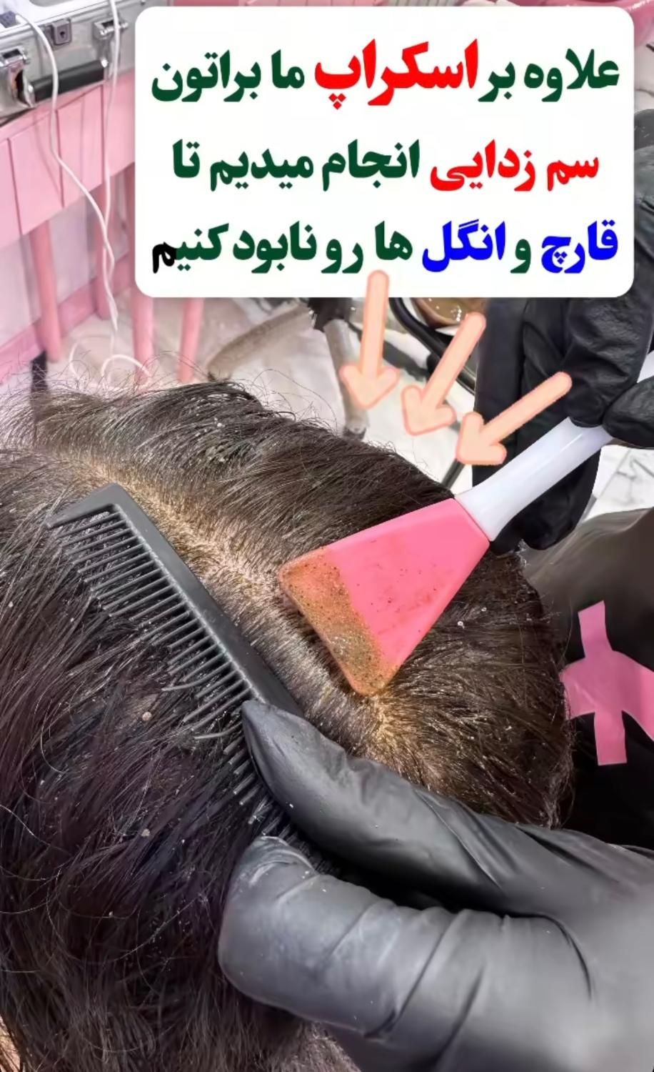 آموزش اسکراپ اسکالپ (پاکسازی کف سر)|خدمات آرایشگری و زیبایی|تهران, نارمک جنوبی|دیوار