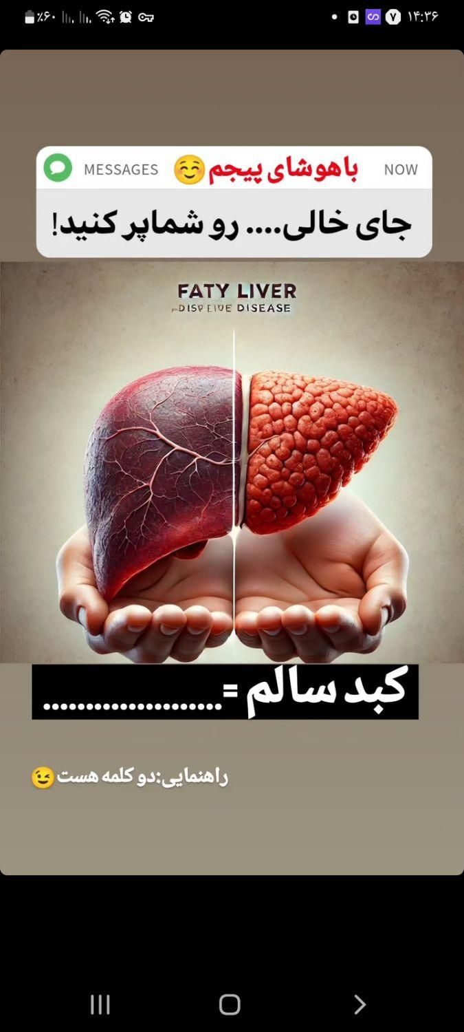 پاک سازی کبد چرب|آرایشی، بهداشتی، درمانی|گنبد کاووس, |دیوار