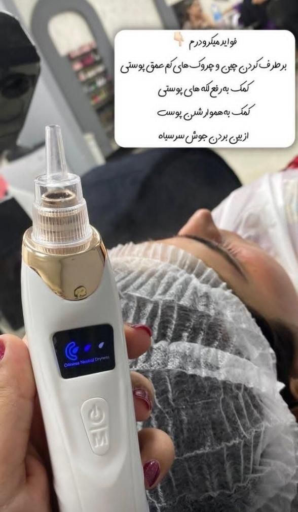 دستگاه فشیال درما پلنینگ . پاکسازی و آبرسانی|آرایشی، بهداشتی، درمانی|زابل, |دیوار