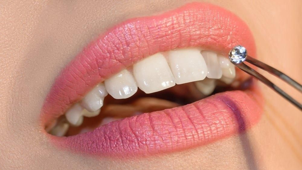 دندانپزشکی زیبایی و درمان با تخفیف ویژه افتتاحیه|خدمات آرایشگری و زیبایی|کرج, اصفهانی‌ها|دیوار