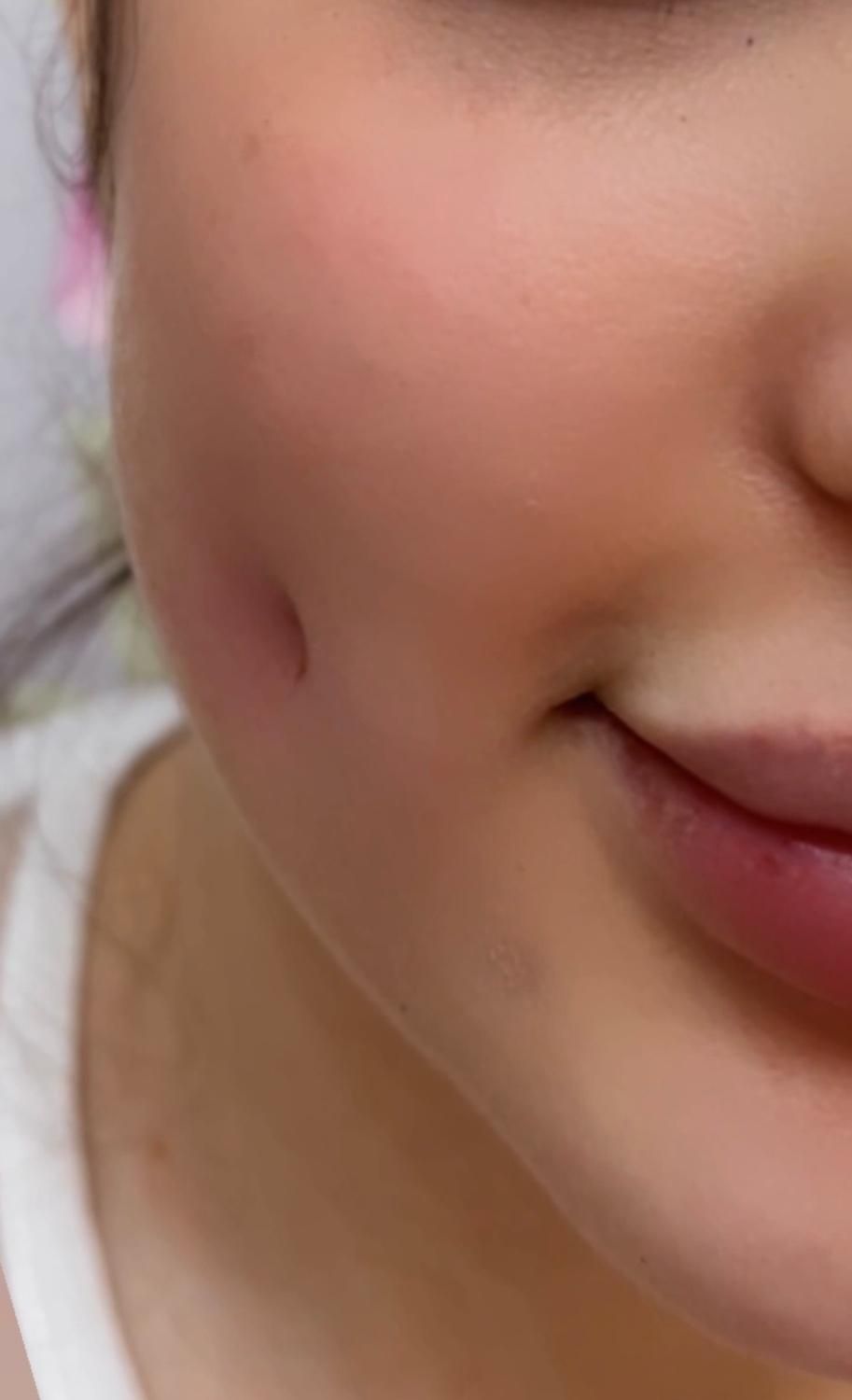 آموزش فوق تخصصی پرسینگ میکرو چال لپ هیدن|خدمات آموزشی|تهران, بهاران|دیوار