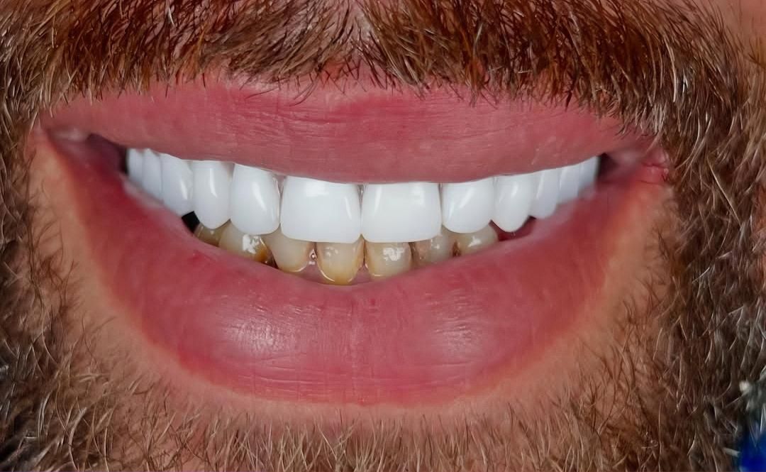 دندان مصنوعی تخصص ماست..|خدمات آرایشگری و زیبایی|پردیس, فاز ۸|دیوار