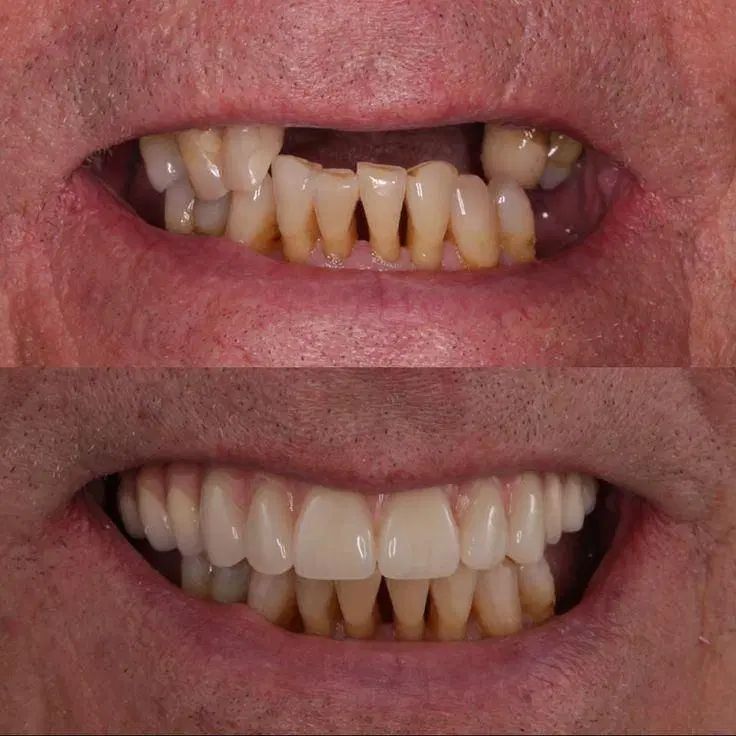 دندانپزشکی ایمپلنت اقساط ۲۴ ماهه|خدمات آرایشگری و زیبایی|تهران, میرداماد|دیوار