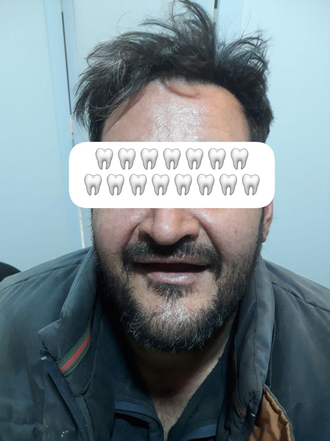 دندانسازی رستمی|خدمات آرایشگری و زیبایی|زنجان, |دیوار