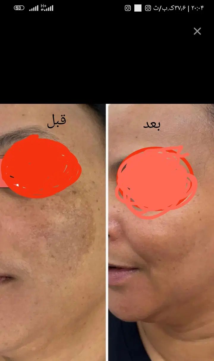 مشاوره وهمکاری|فعالیت داوطلبانه|مشهد, شهید فرامرز عباسی|دیوار