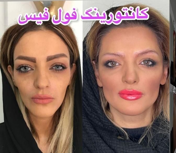 فیلر.ژل.بوتاکس.زاویه سازی.پی ارپی فول فیس|خدمات آرایشگری و زیبایی|مشهد, سناباد|دیوار
