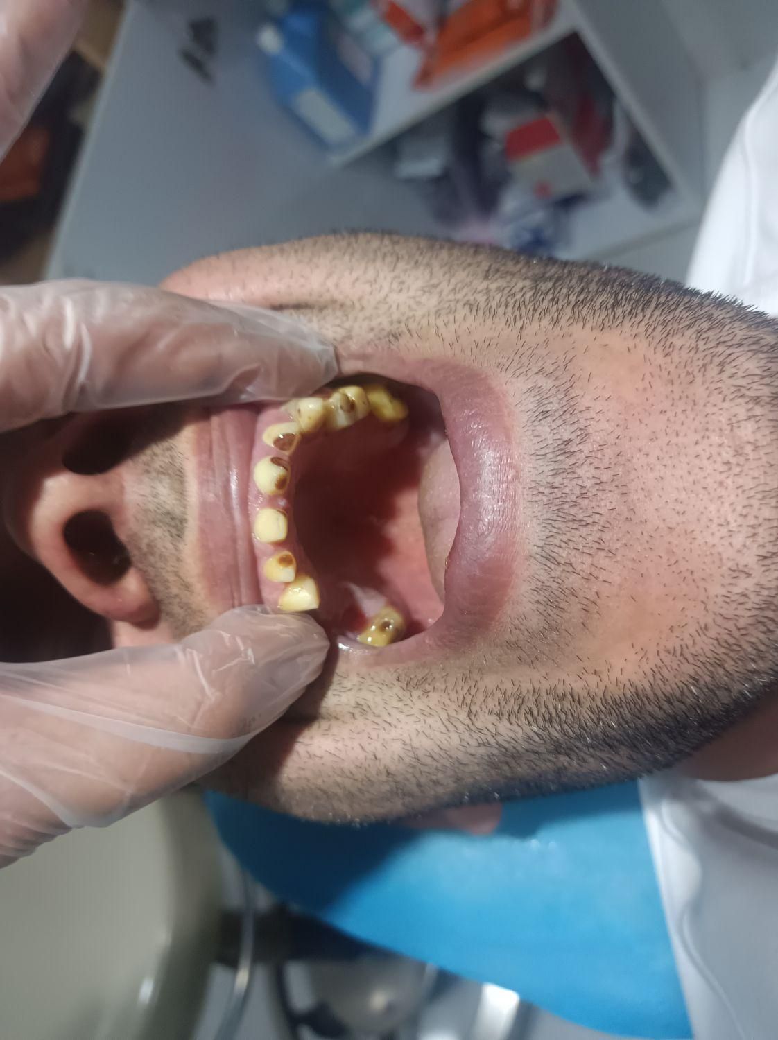 دندان سازی|خدمات آرایشگری و زیبایی|خوی, |دیوار