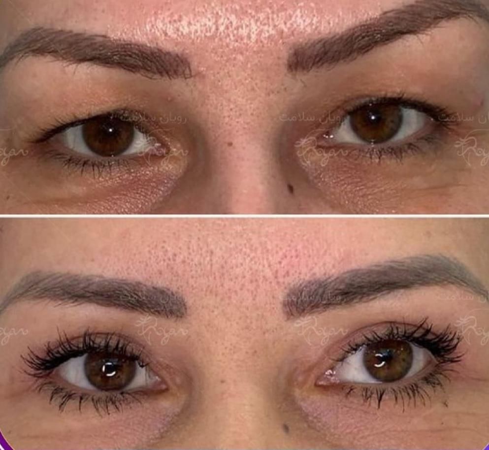 کاشت ابروعمل پلک لیفت کانتور بوکال لیپو غبغب، ژل|خدمات آرایشگری و زیبایی|کرج, عظیمیه|دیوار