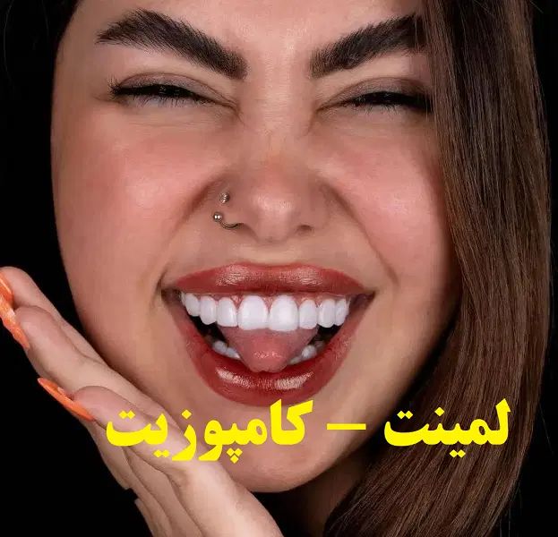 دندانپزشکی/ترمیم/کامپوزیت/لمینیت/عصبکشی قسطی|خدمات آرایشگری و زیبایی|مشهد, سجاد شهر|دیوار