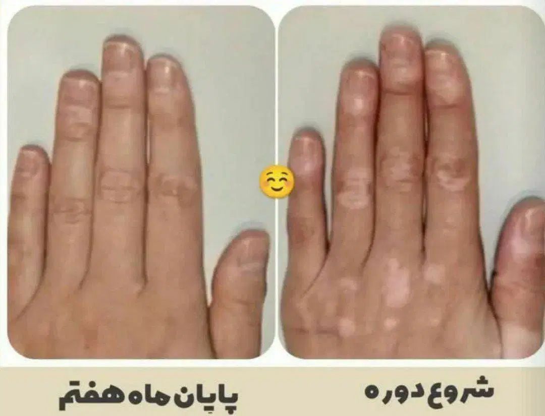 استقلال مالی ودرمان باطب سنتی آنلاین ویژه بانوان|استخدام بازاریابی و فروش|کرج, اکبرآباد|دیوار