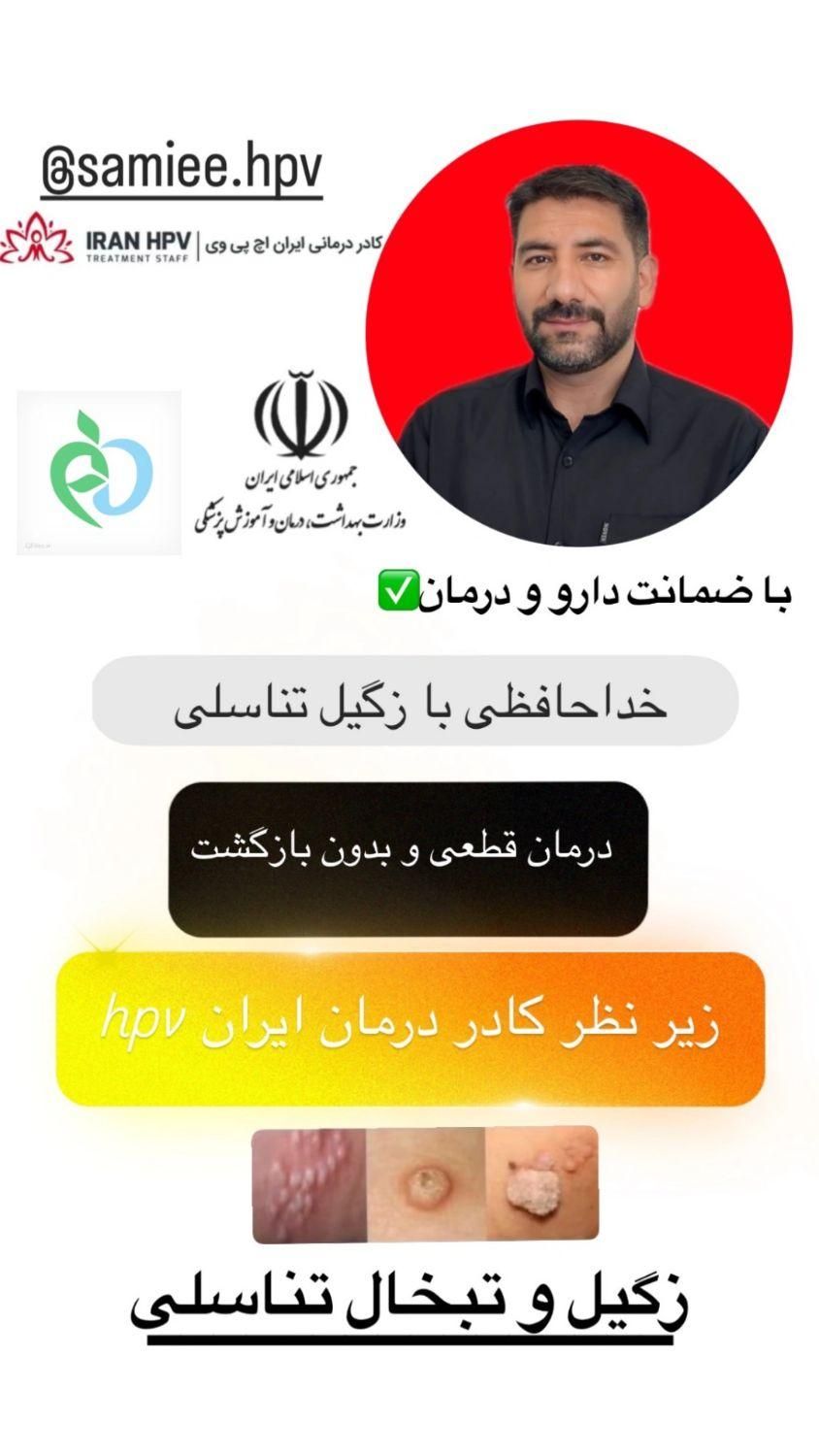حذف ریشه ای زگیل و تبخال|خدمات آرایشگری و زیبایی|رشت, معلم|دیوار