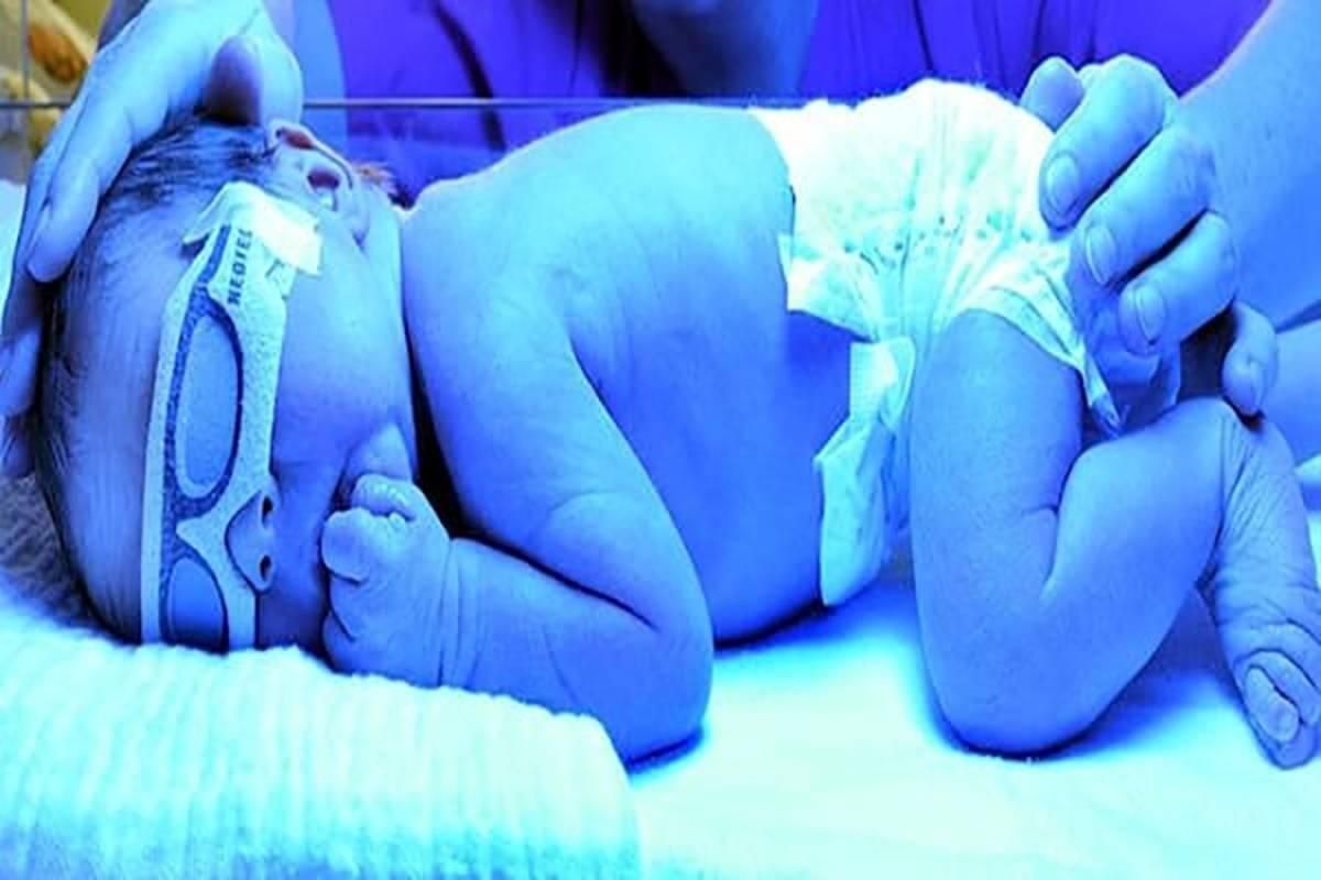 دستگاه زردی فتوتراپی|پزشکی|قزوین, |دیوار