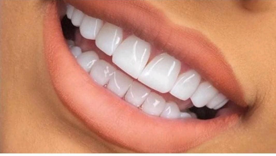 دندانپزشکی به صورت نقدو اقساط ، بدون هیچ بهره ای|خدمات آرایشگری و زیبایی|شیراز, قصرالدشت|دیوار