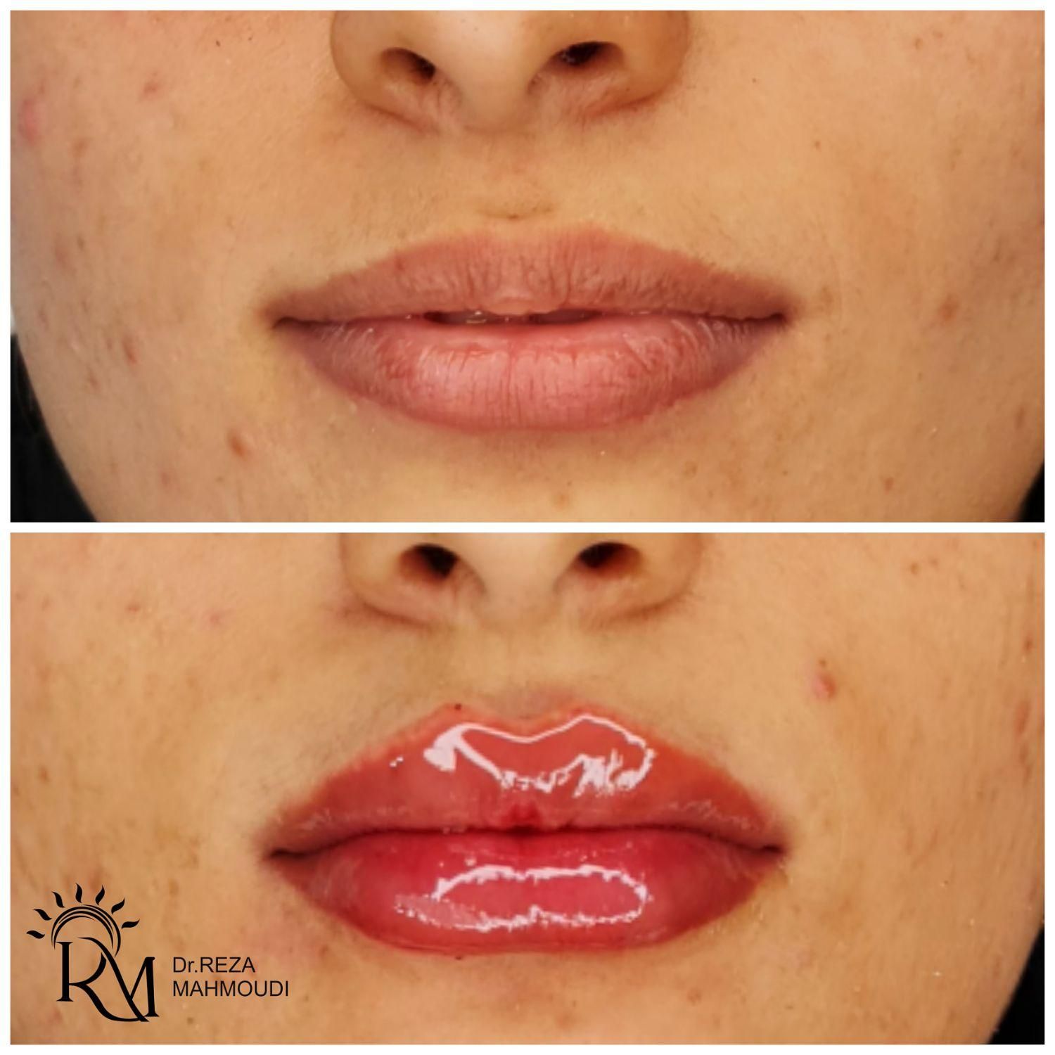 جشنواره  زیبایی کلینیک دکتر محمودی|خدمات آرایشگری و زیبایی|کرمان, |دیوار