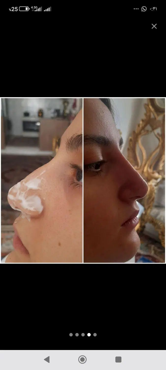 خدمات ژل بوتاکس مزو فیلر انزیم بوتاکس|خدمات آرایشگری و زیبایی|تهران, تهرانسر مرکزی|دیوار