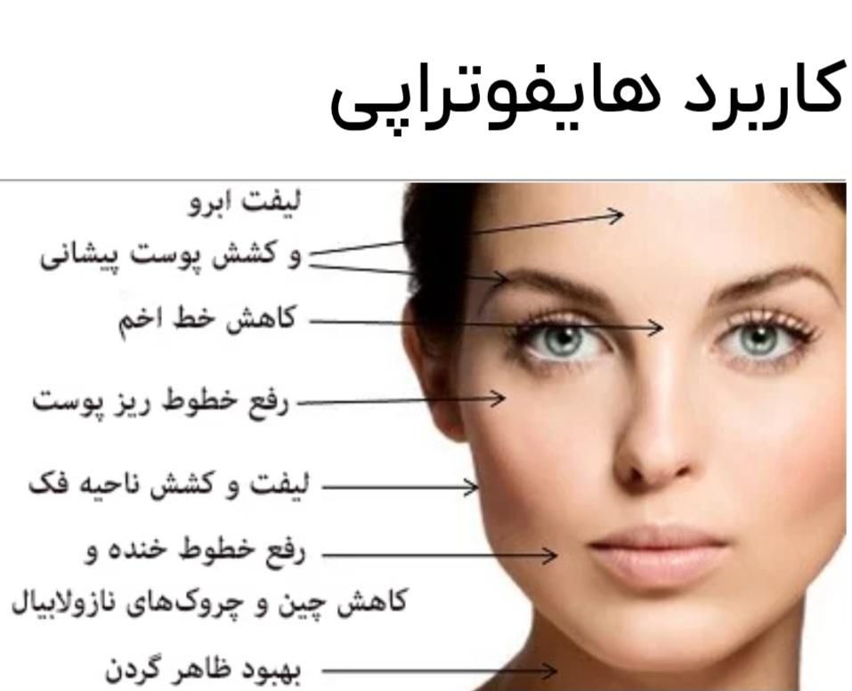 مرکز تخصصی هایفو|خدمات آرایشگری و زیبایی|اصفهان, سعادت‌آباد|دیوار