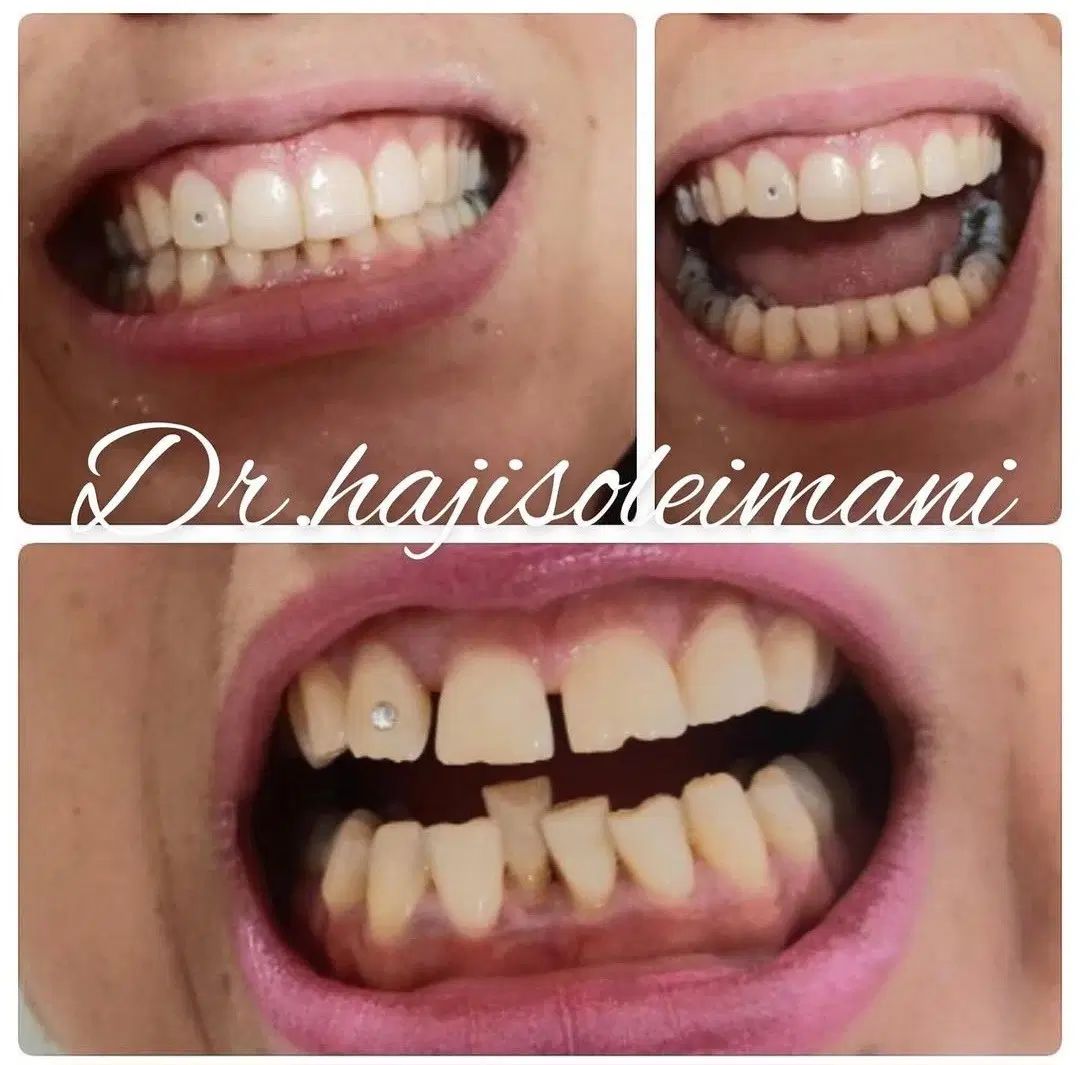 مدل دندانپزشکی|خدمات آرایشگری و زیبایی|تهران, درختی|دیوار