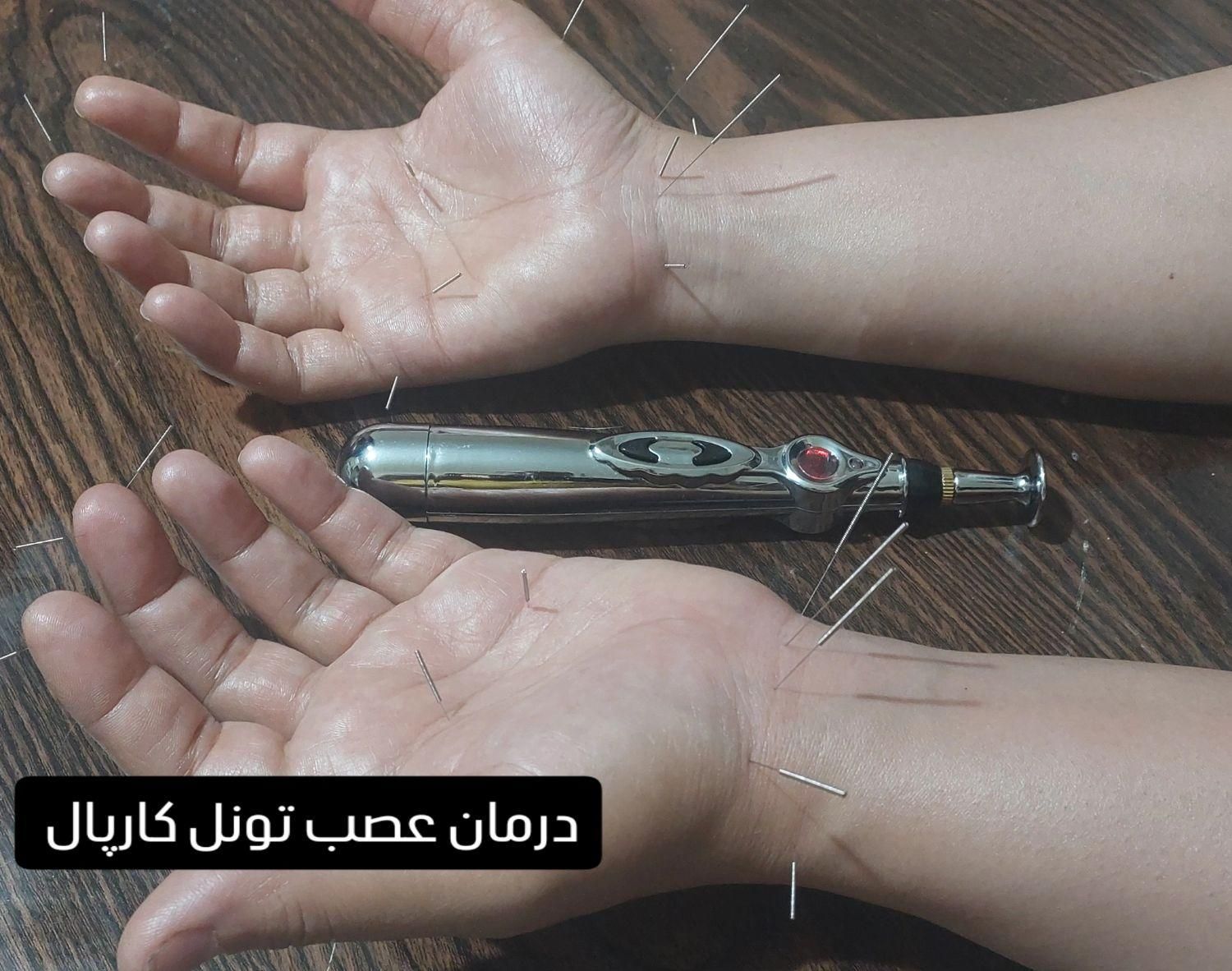 ماساژ..طب سوزنی.|خدمات آرایشگری و زیبایی|نیشابور, شهرک جانبازان|دیوار