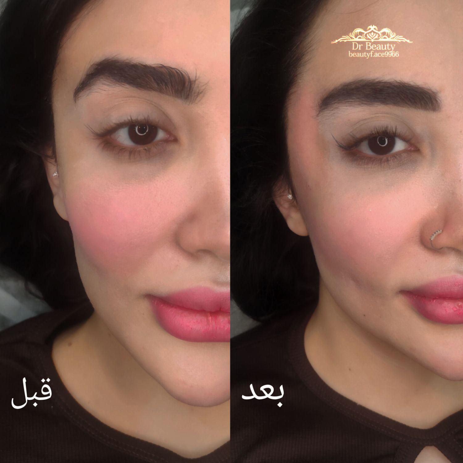 کلنیک زیبایی  لیزر تتو بدن، تزریق ژل و بوتاکس و...|خدمات آرایشگری و زیبایی|اسلام‌شهر, شهرک واوان|دیوار