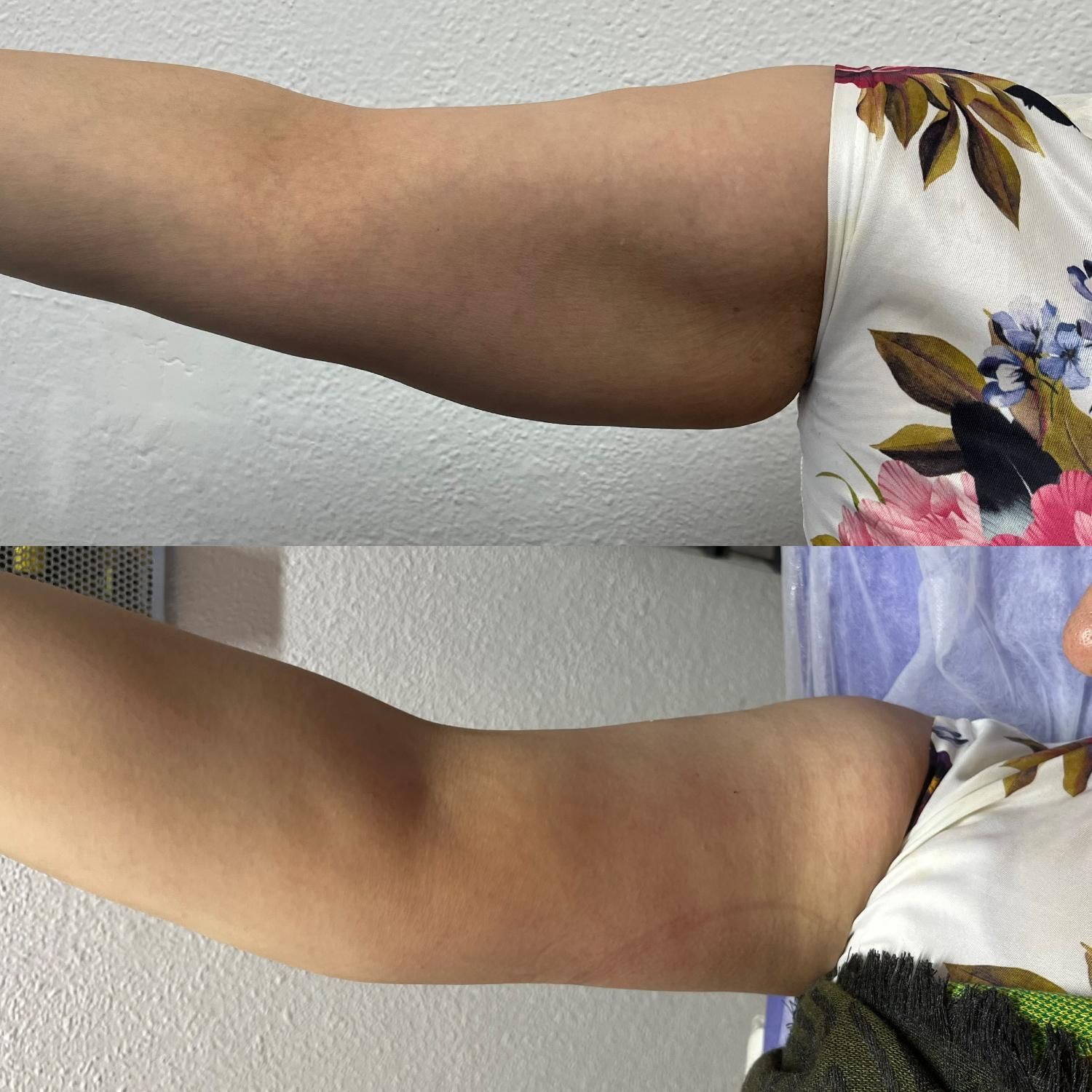 غول لاغری رسید، تضمینی ،پیکرتراشی بدون عمل|خدمات آرایشگری و زیبایی|مشهد, شهید فرامرز عباسی|دیوار