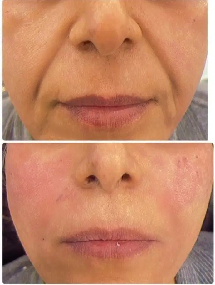 کلینیک زیبایی خدمات فیلر بوتاکس مزوژل PRP|خدمات آرایشگری و زیبایی|اهواز, کیان اباد|دیوار