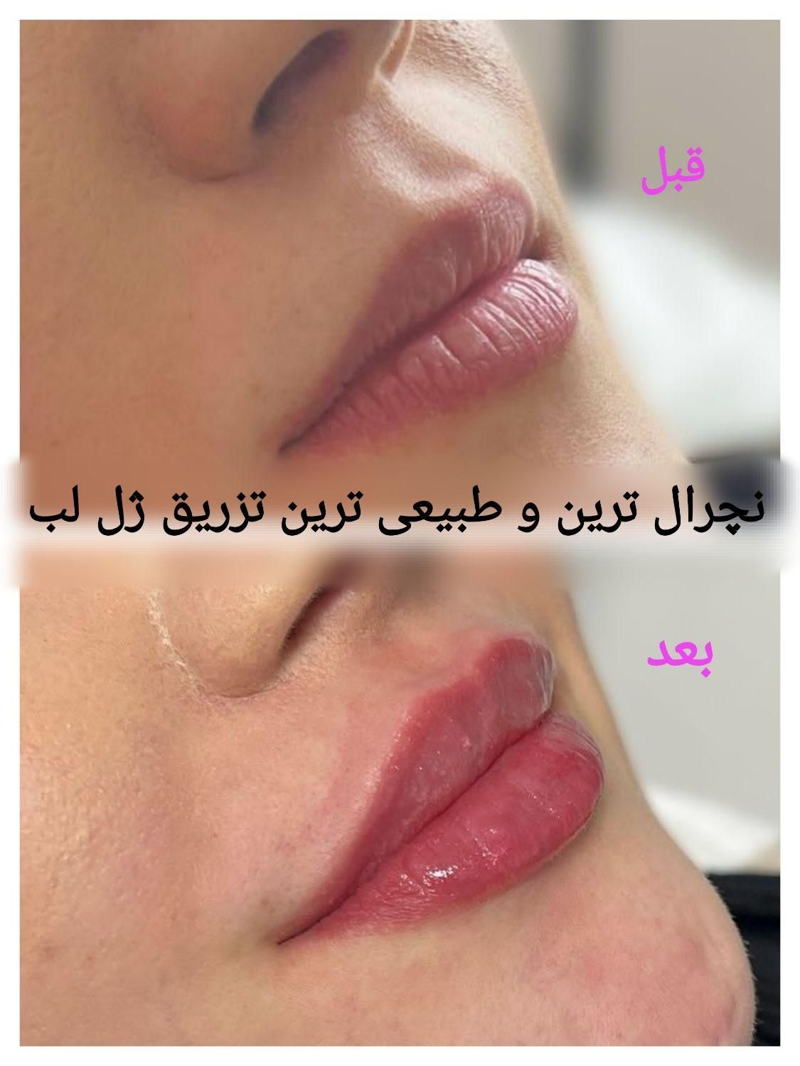 کلینیک پوست و زیبایی (تمام خدمات توسط پزشک)|خدمات آرایشگری و زیبایی|مشهد, کوه سنگی|دیوار