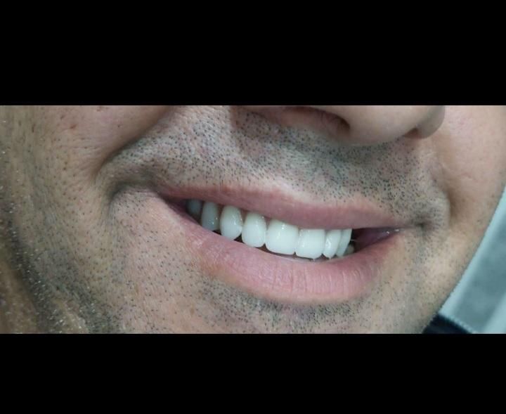 بهدارتجربی دندان و دندانساز|خدمات آرایشگری و زیبایی|بروجرد, |دیوار