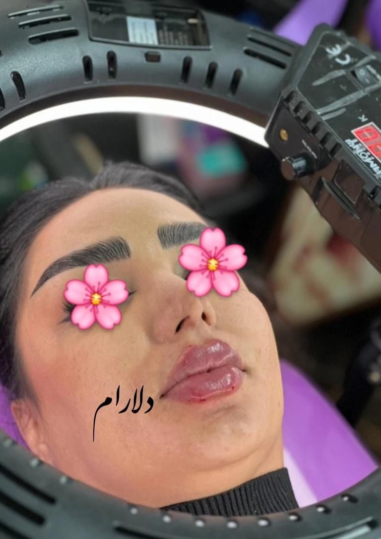 ژل و بوتاکس - مدلنیگ عربی-آموزش حرفه ای|خدمات آرایشگری و زیبایی|شیراز, شهرک مهرگان|دیوار