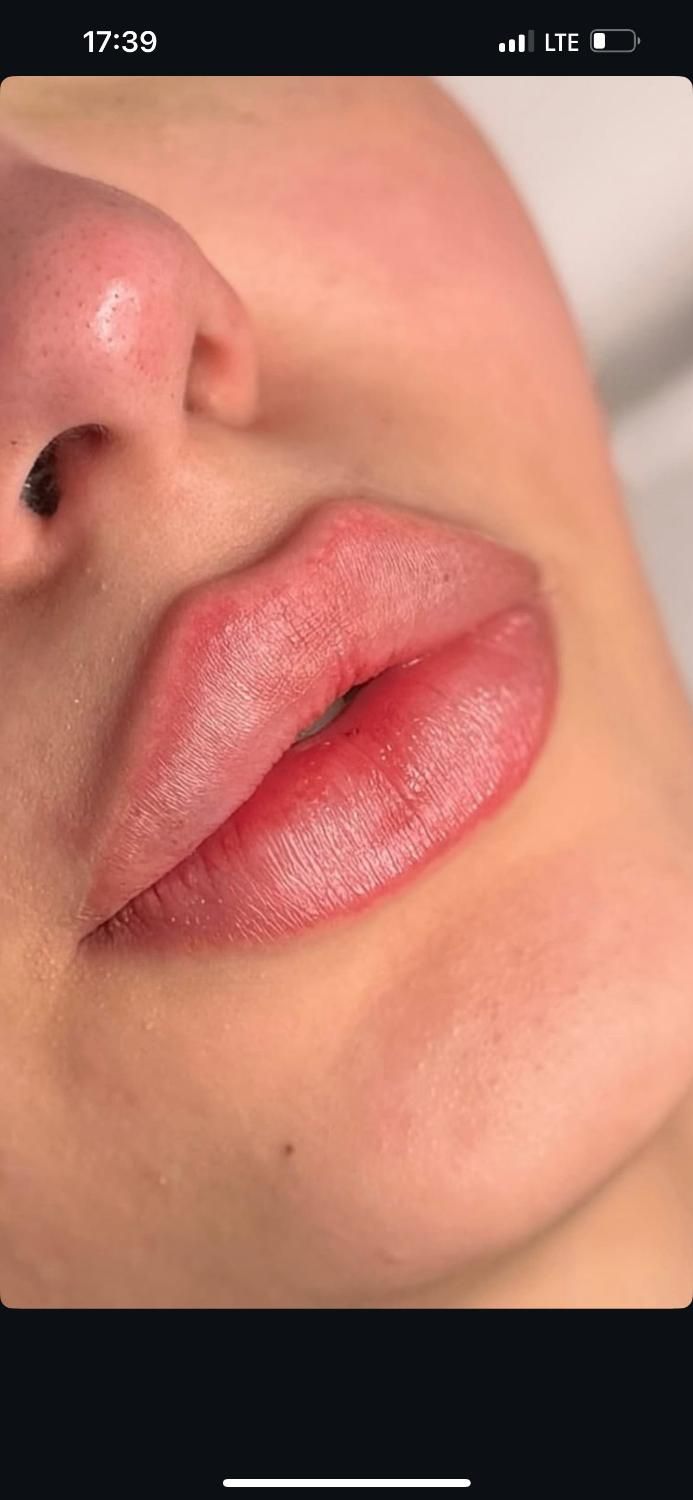 جشنواره تابستانه مطب پزشک زیبایی|خدمات آرایشگری و زیبایی|شیراز, ابیوردی|دیوار