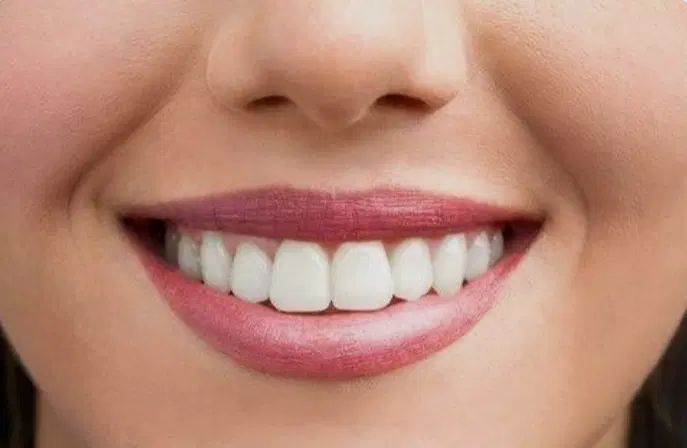 دندان مصنوعی باکیفیت عالی از لابراتور دندانسازی|آرایشی، بهداشتی، درمانی|تبریز, |دیوار