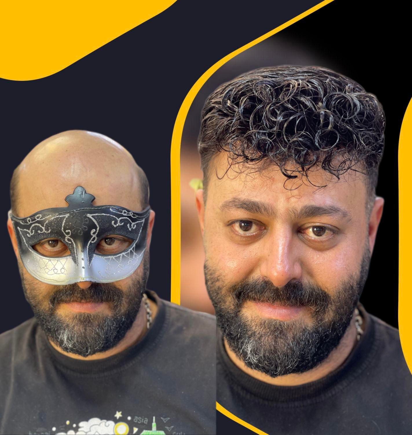 مرکز تخصصی پروتزمو /ترمیم مو در اصفهان|خدمات آرایشگری و زیبایی|اصفهان, خرم|دیوار