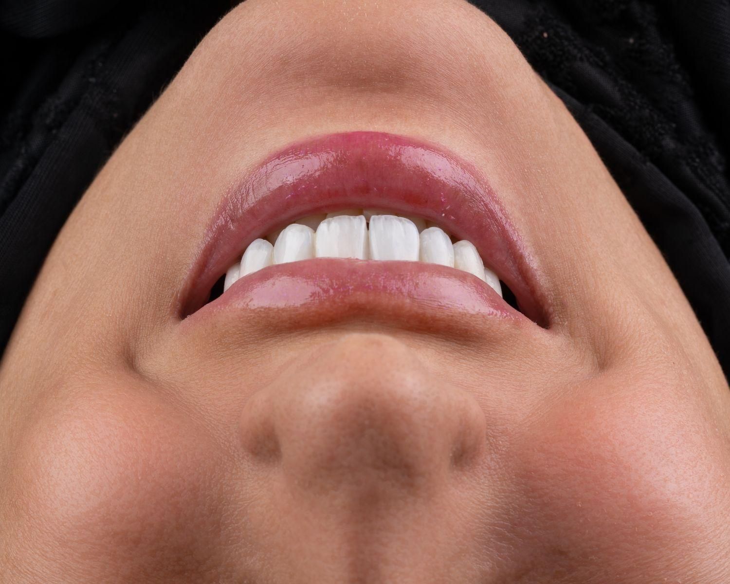 دندانپزشکی، لمینت،ایمپلنت ،دیجیتال،نقدواقساط|خدمات آرایشگری و زیبایی|مشهد, سناباد|دیوار