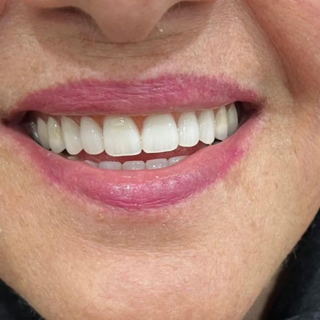 ساخت دندان و دندان سازی قدیری|خدمات آرایشگری و زیبایی|یزد, |دیوار