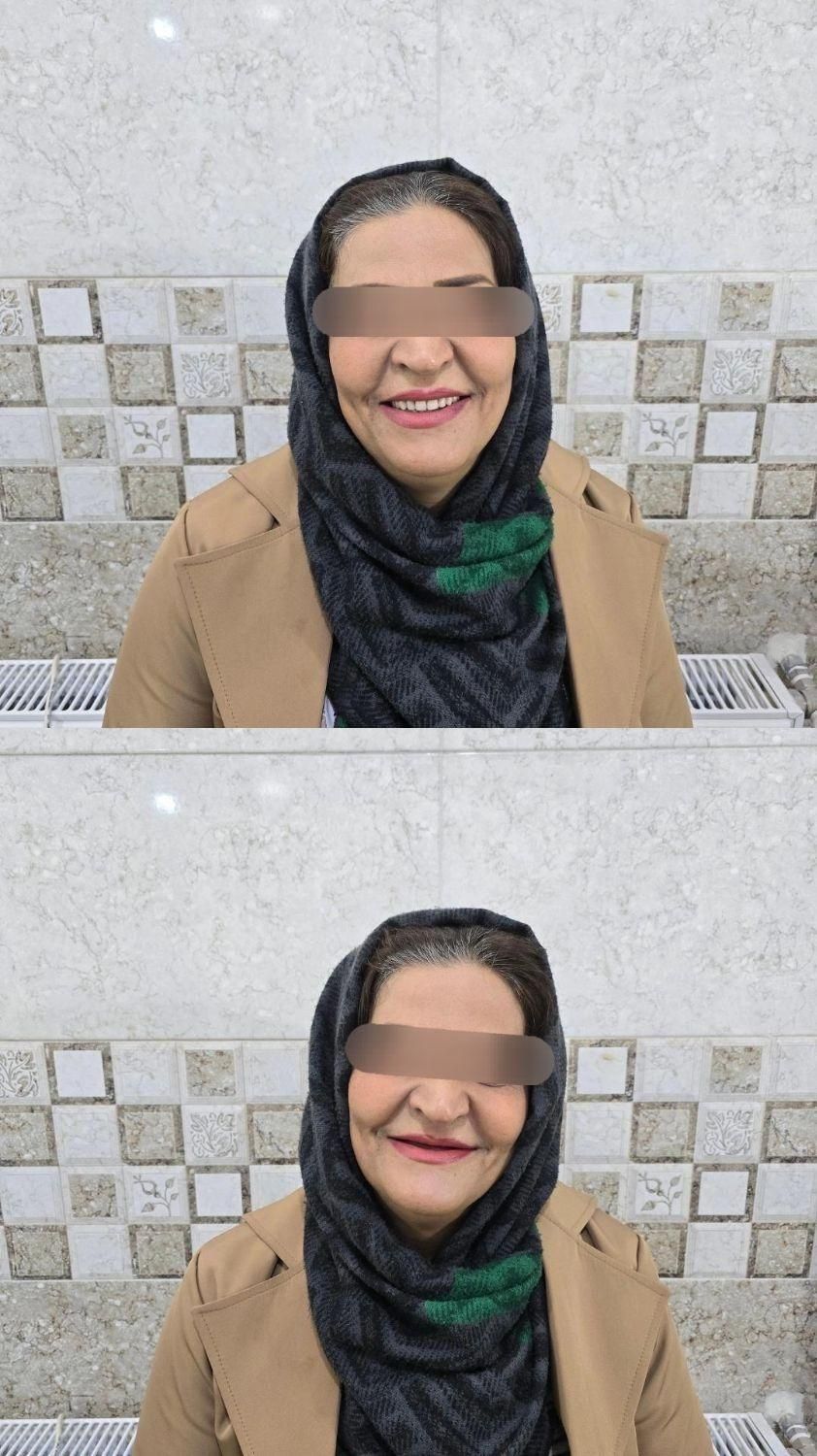 دندانسازی|خدمات آرایشگری و زیبایی|اقلید, |دیوار