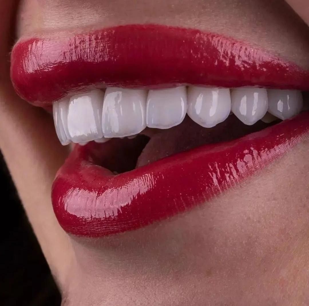 تخفیف های ویژه دندانپزشکی،کامپوزیت زیبایی،عصب کشی|خدمات آرایشگری و زیبایی|آبادان, |دیوار