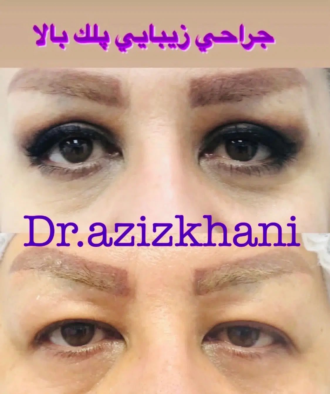 جشنواره تابستانی ۵۰٪ بلفارو پلاستی .تیپ پلاستی|خدمات آرایشگری و زیبایی|تهران, مهران|دیوار