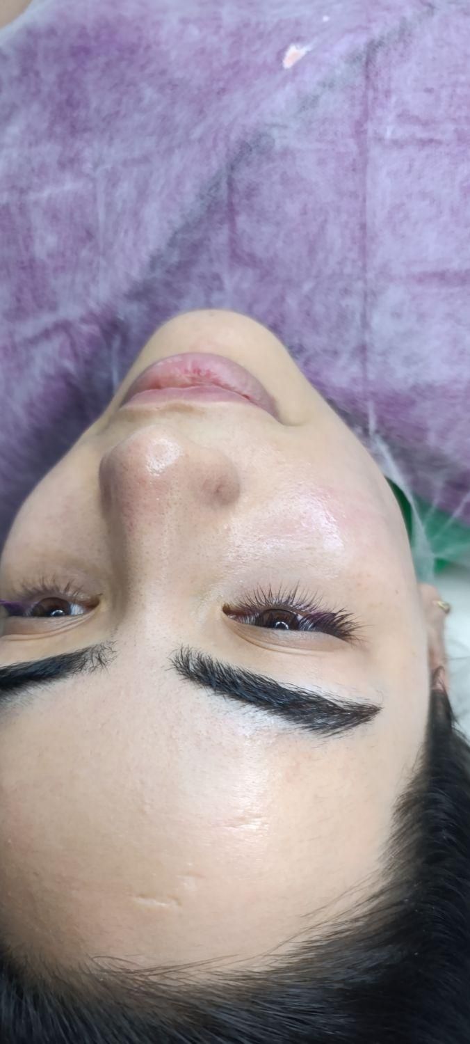 فیشال تخصصی پاکسازی۲۰۰تومان مزو کربوکسی اسیدتراپی|خدمات آرایشگری و زیبایی|مشهد, هدایت|دیوار